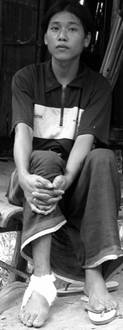 19-year-old Saw Maw Poh Say, shot by Burma Army