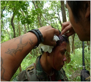 Wounded Shan Soldier
