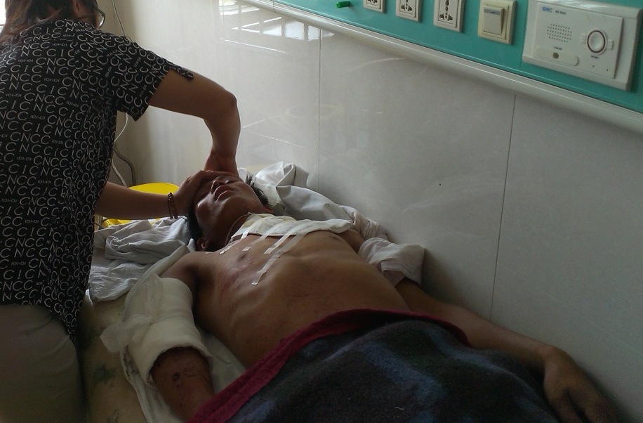 Brang Mao, a 25-year-old man from Maw Swi Ag Lawt Yang was seriously injured by a Burma Army mortar round while he was running to a safe place. He has sustained several broken bones and serious wounds to his abdomen.