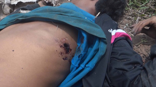 Bullet wound to victims chest