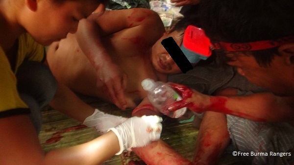 Free Burma Ranger receives treatment