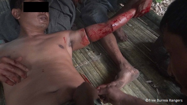 Treatment for shrapnel wound