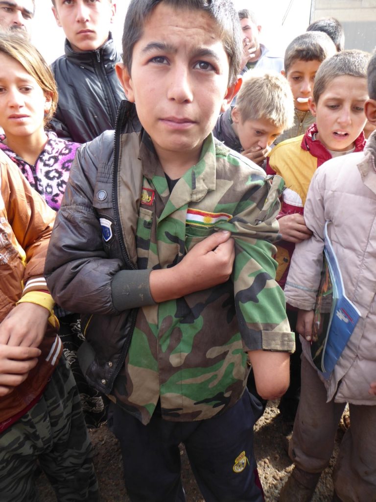 Boy who lost his hand to a exploding shell