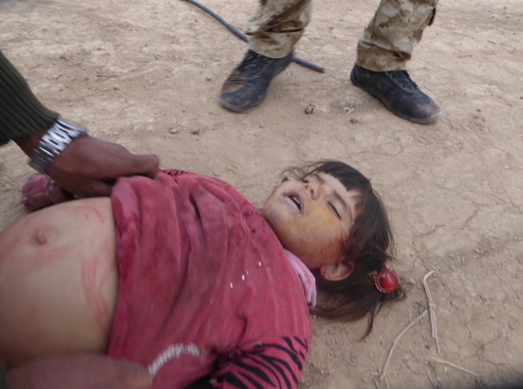 The Three Year Old that Died